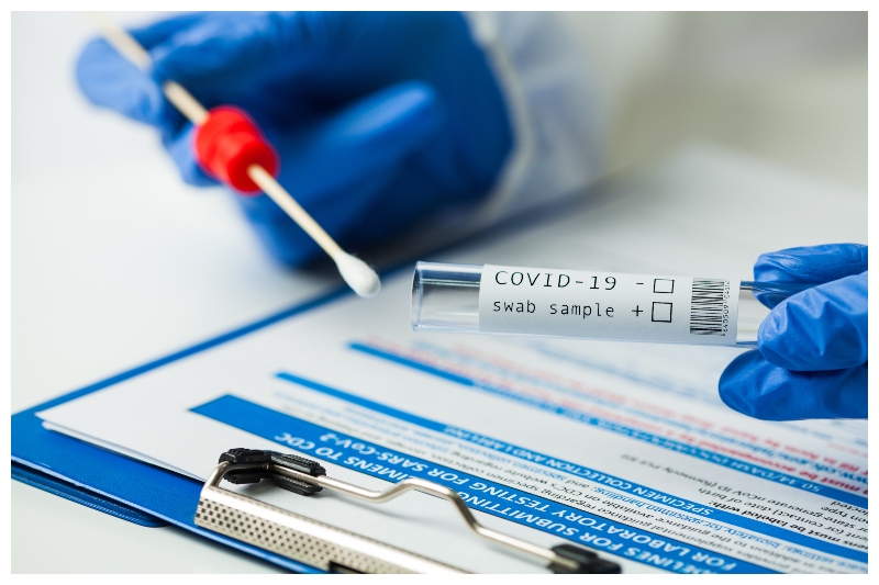 RT-PCR Test of Covid-19